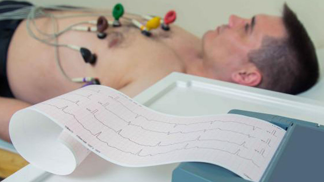  2-3-6-169-electrocardiogram