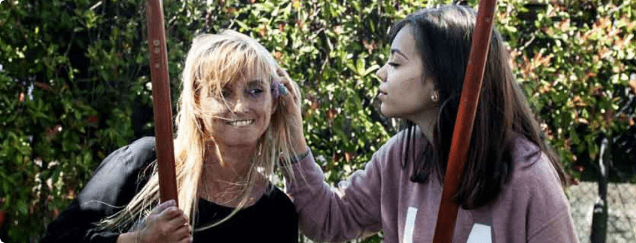 Understanding scleroderma