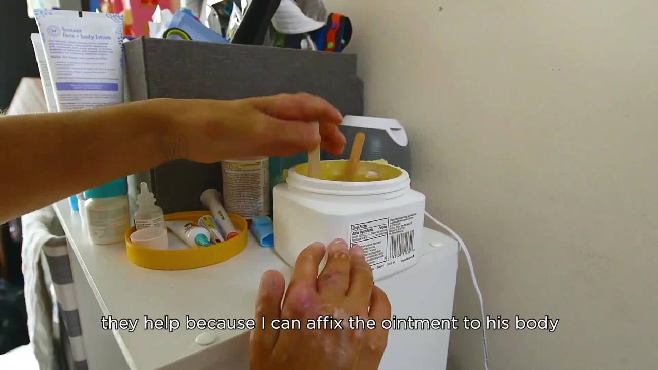 Changing your babies diaper