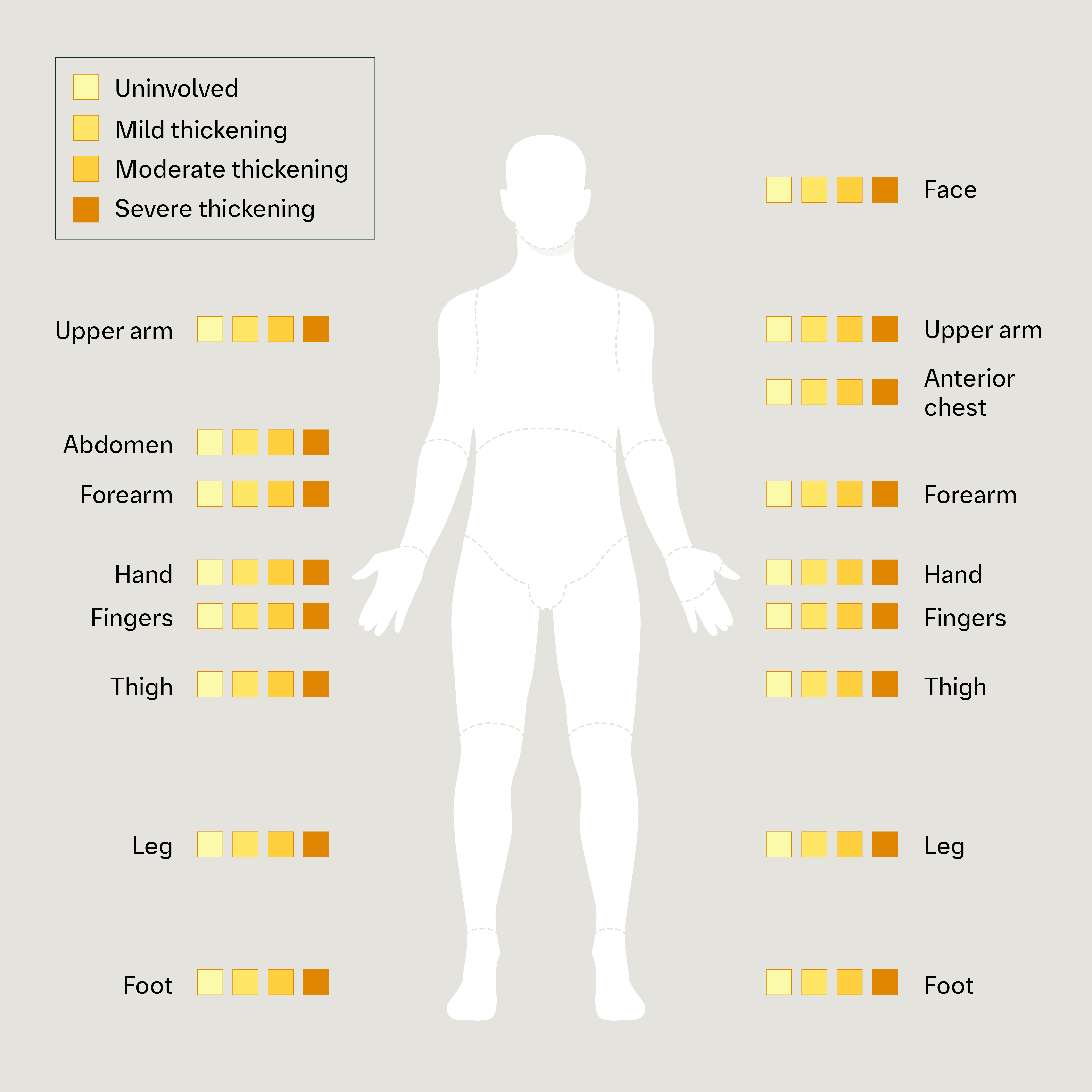 2-3-5-modified rodnan skin thickness score diagram