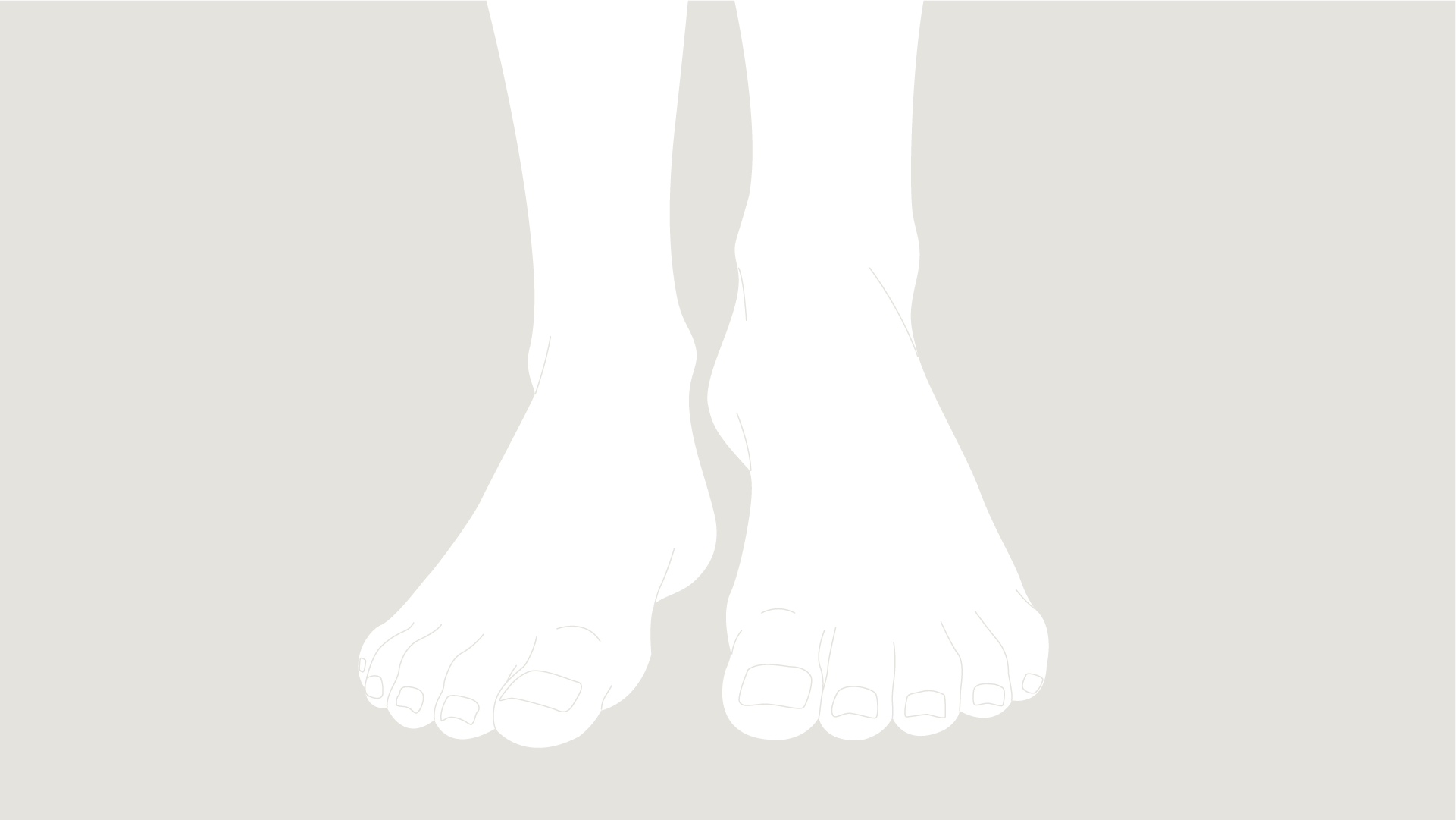 Feet Symptoms