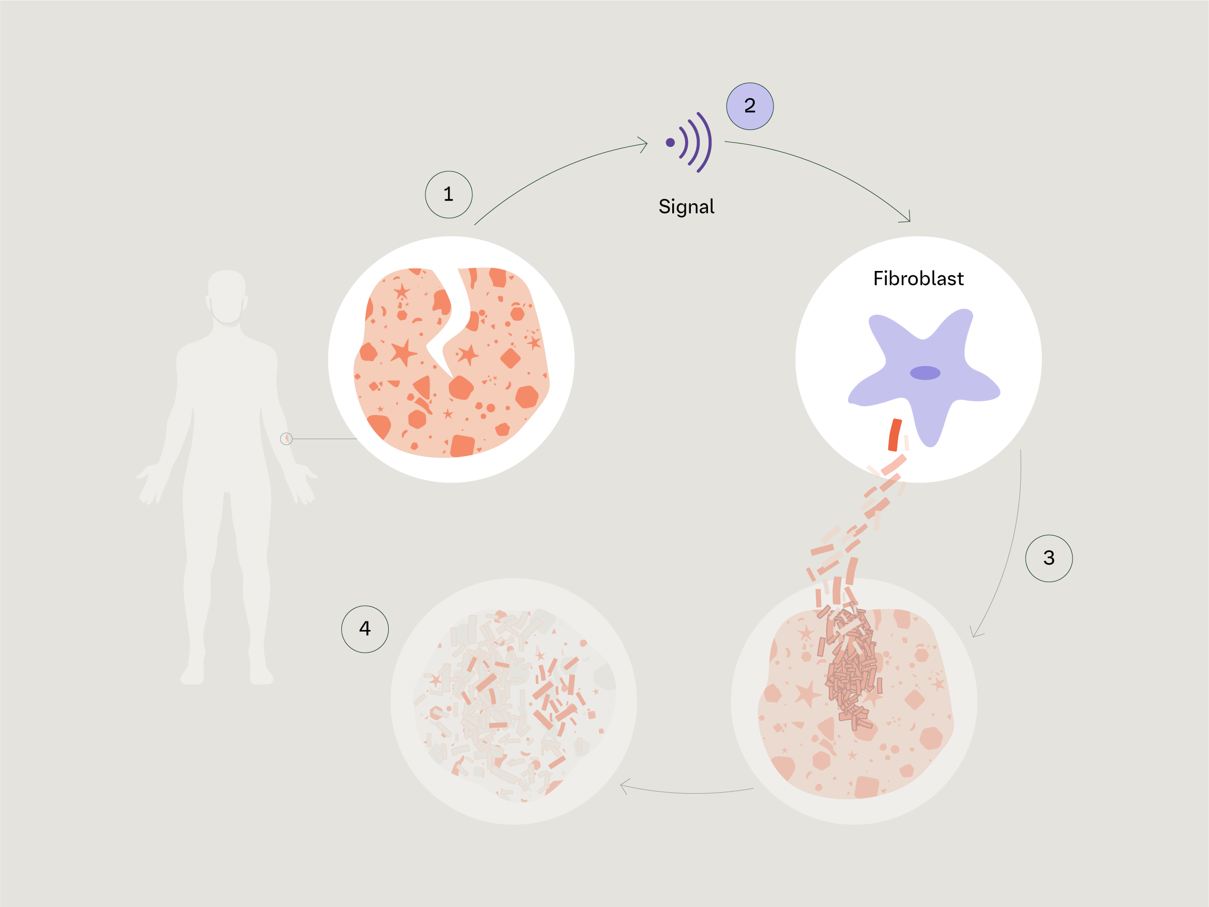 Healing Cycle in Scleroderma 2