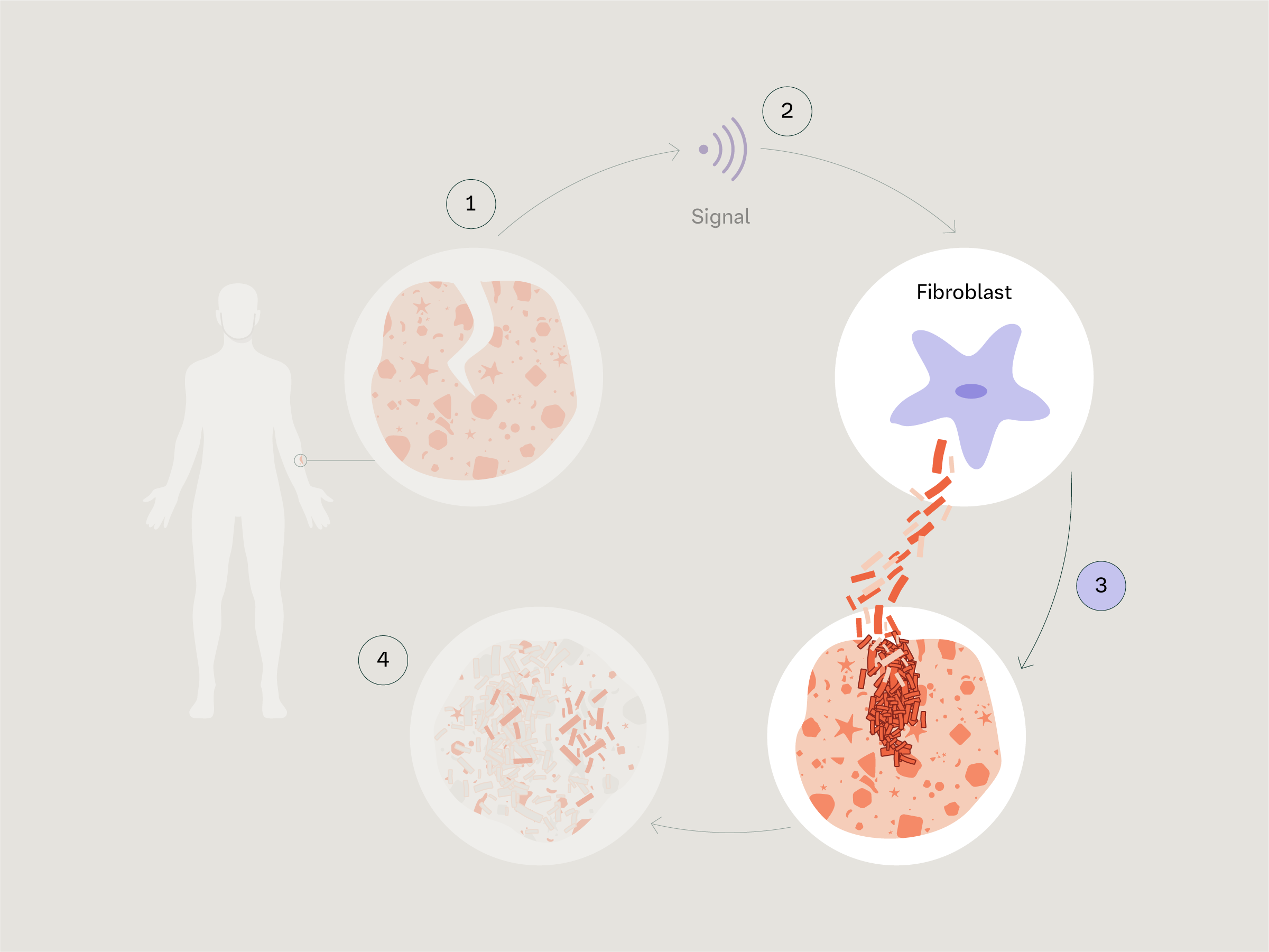 Healing Cycle in Scleroderma 3