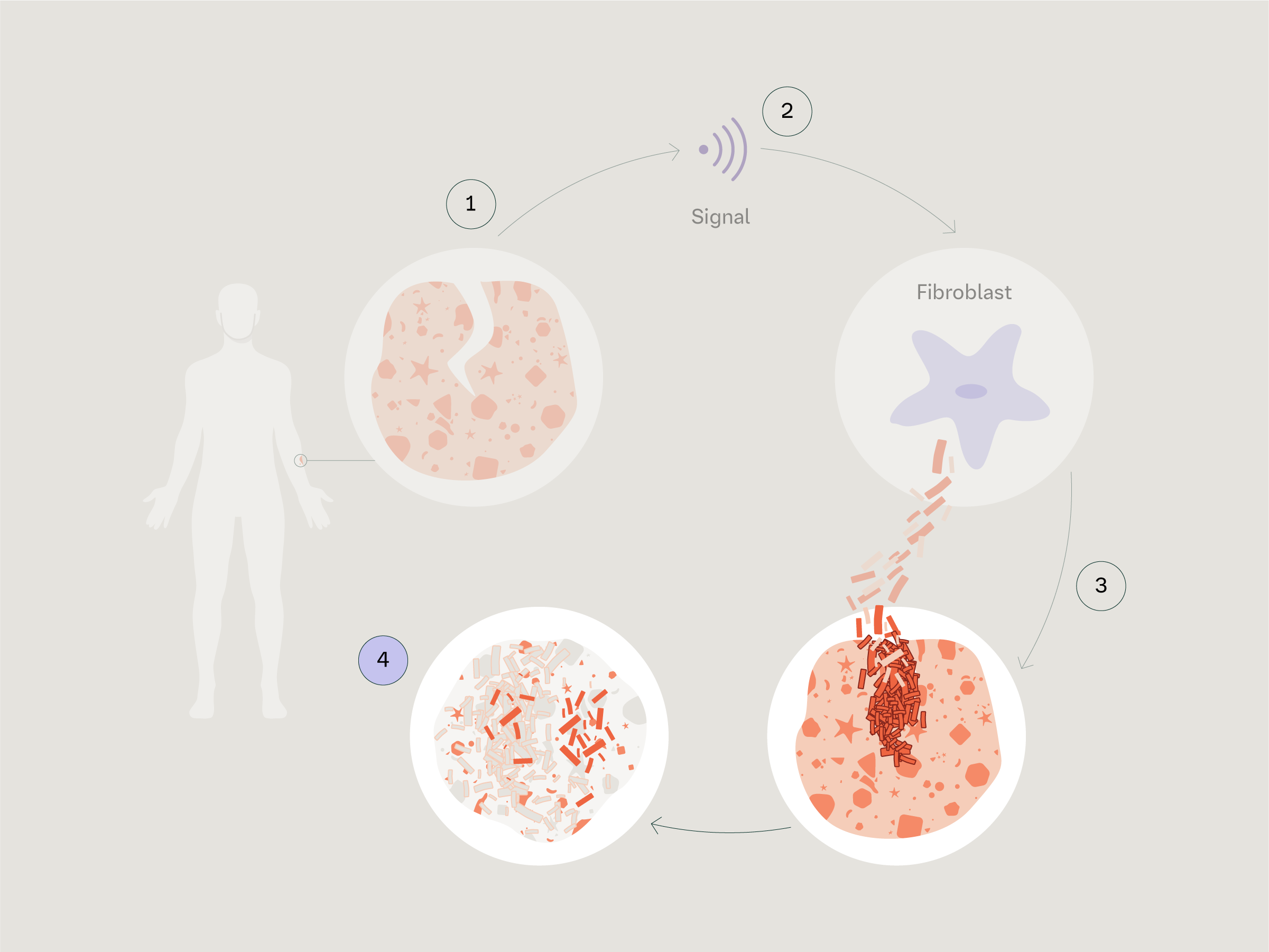 Healing Cycle in Scleroderma